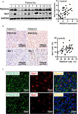 Programmed Cell Death 10 Mediated CXCL2-CXCR2 Signaling in Regulating Tumor-Associated Microglia/Macrophages Recruitment in Glioblastoma